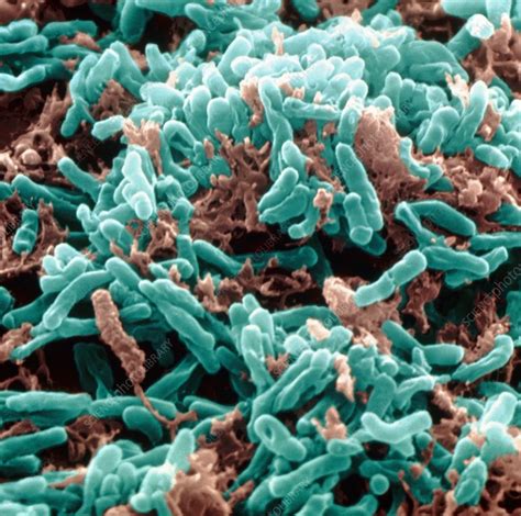 mycobacterium tuberculosis - login spotify